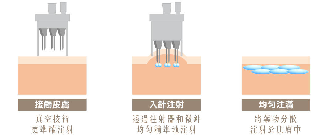 Hycoox海庫斯水光介紹